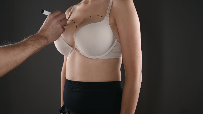 Precision Beauty: Mastering Breast Augmentation in Miami post thumbnail image